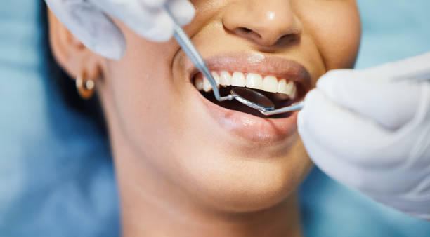 Best Emergency Treatment for Dental Infections or Abscesses in Pearl River, MS